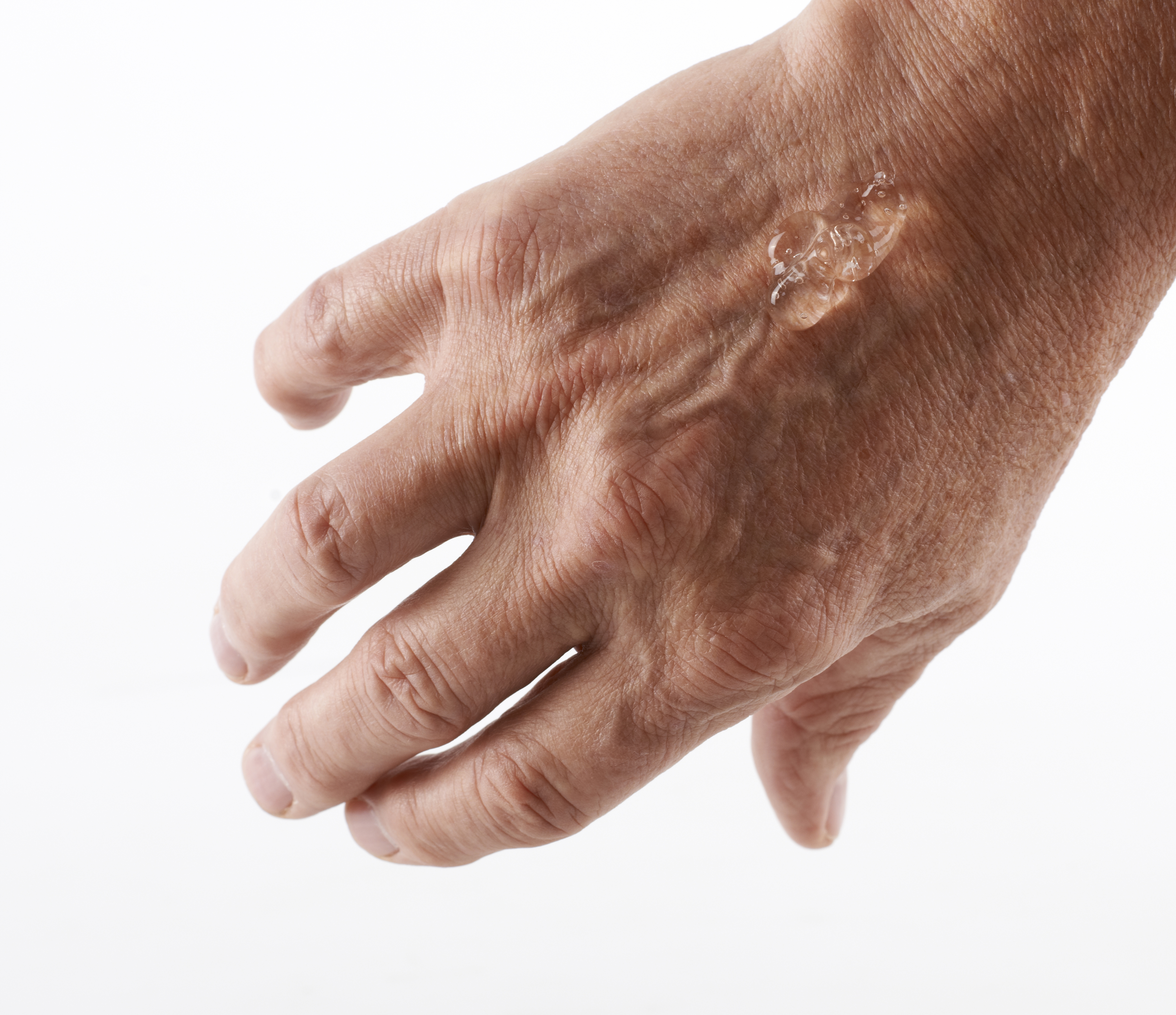 KRUUSE HydroGel w. Polyhexanide 0.04%, sterile, 15 g x 10/pk