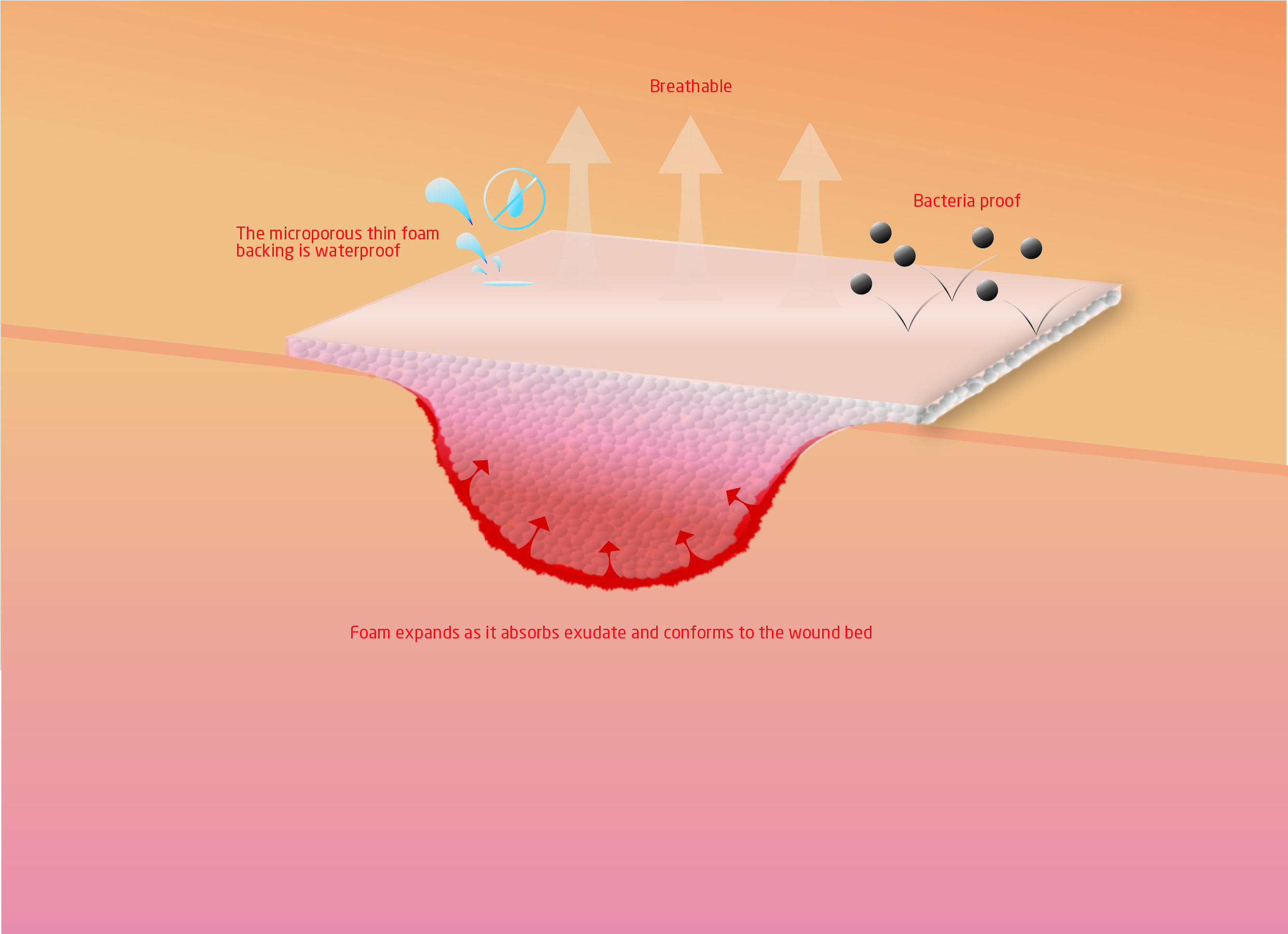 KRUUSE Foam Dressing, sterile, 10 x 20 cm, 10/pk