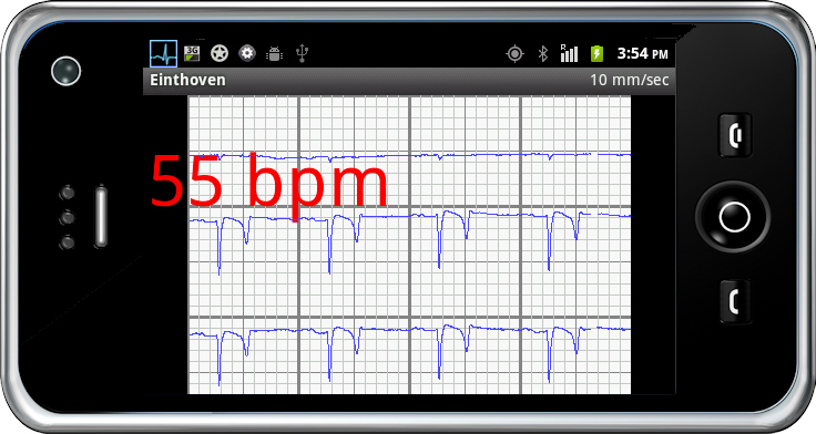 KRUUSE Televet Mobile Gateway Kit
