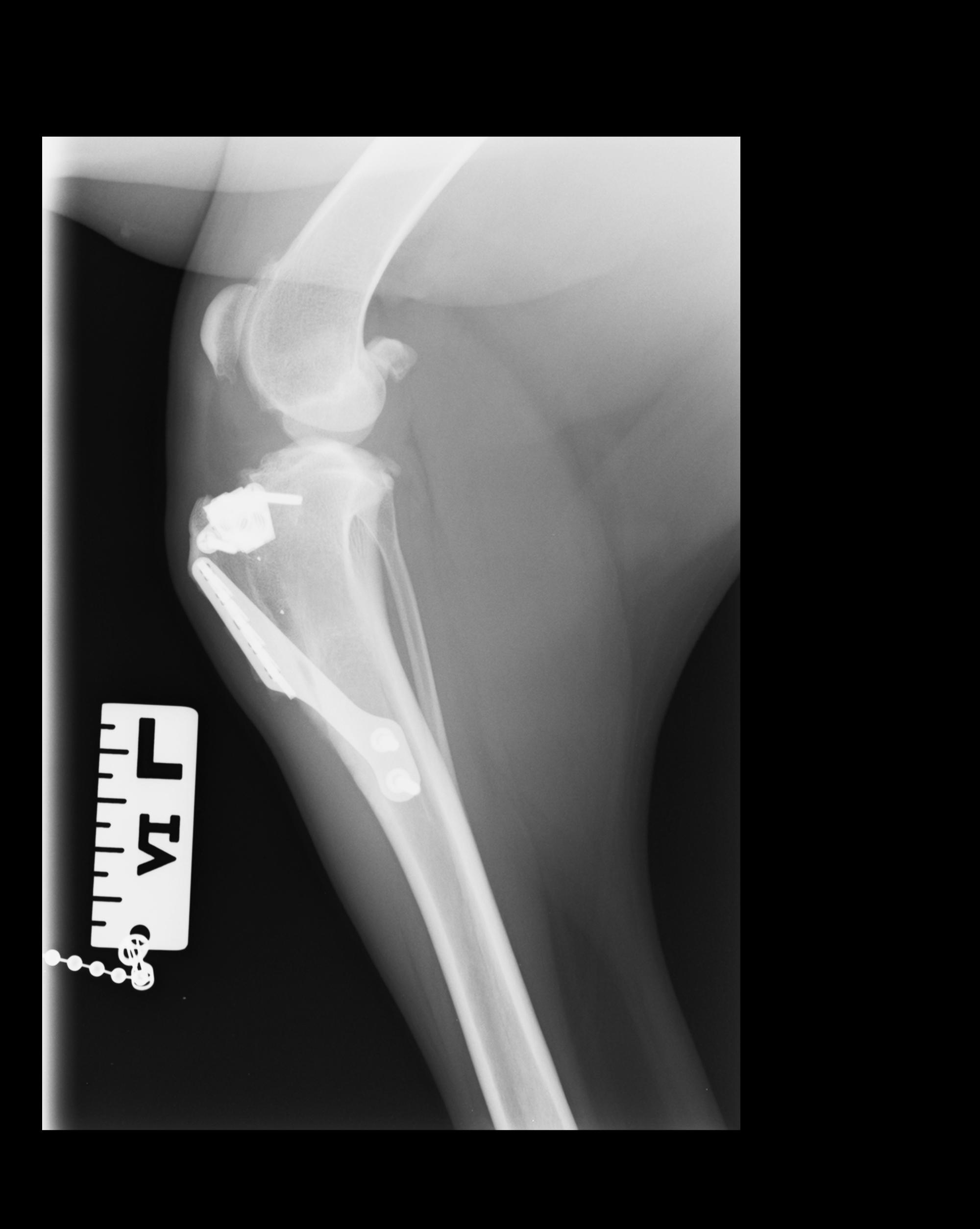 Xray Marker with Scale Set Left and Right [XRAYMARK1]